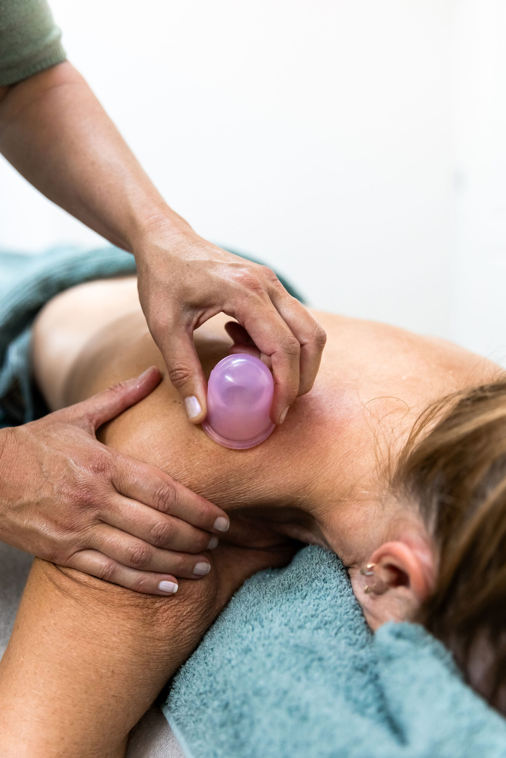 Cupping: wat is het en wat doet het voor je lijf?